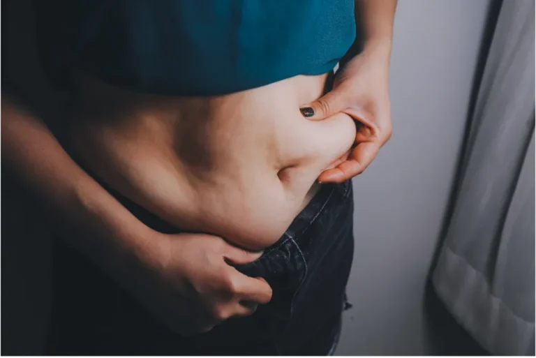 Obesity