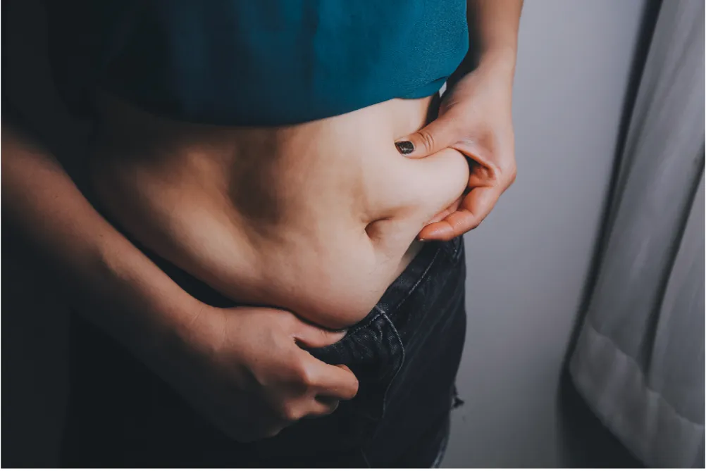Obesity